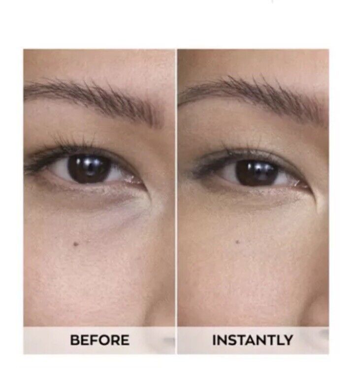 Before and after results showcasing the effectiveness of Avon Anew Renewal Power Eye Cream for youthful, radiant eyes.